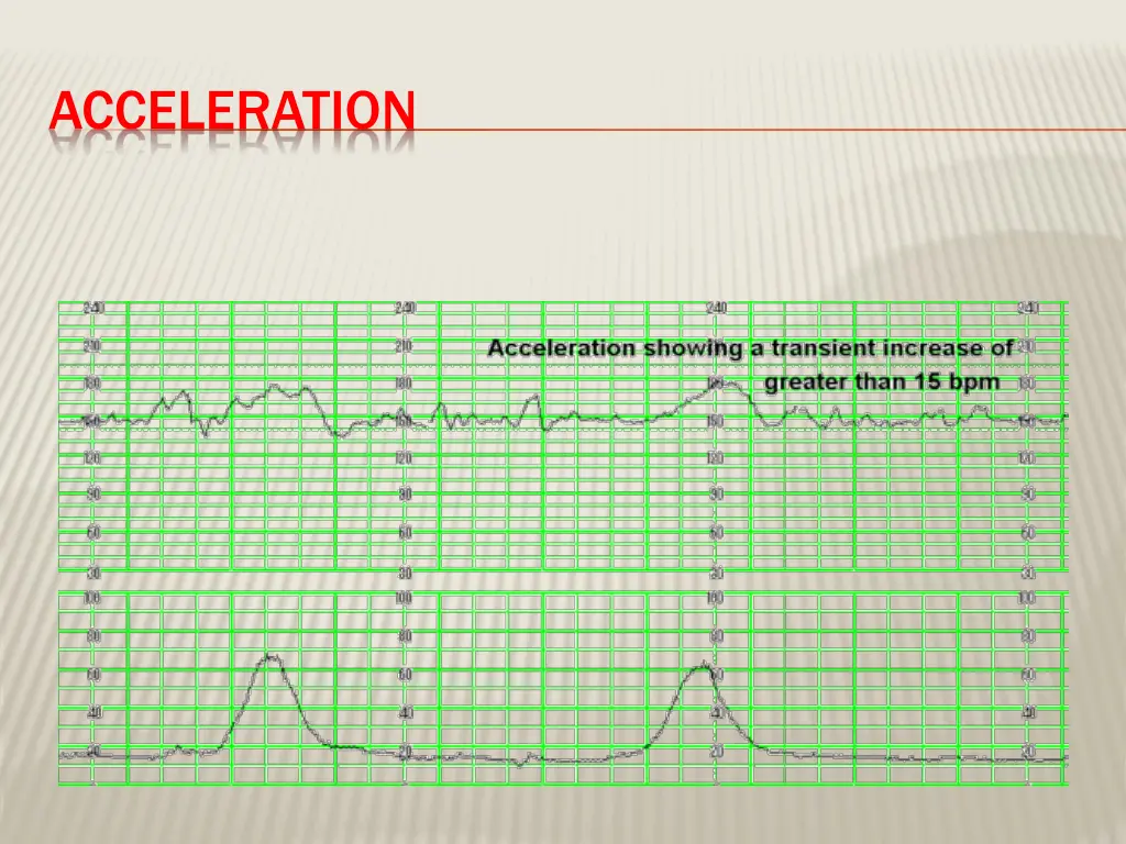 acceleration