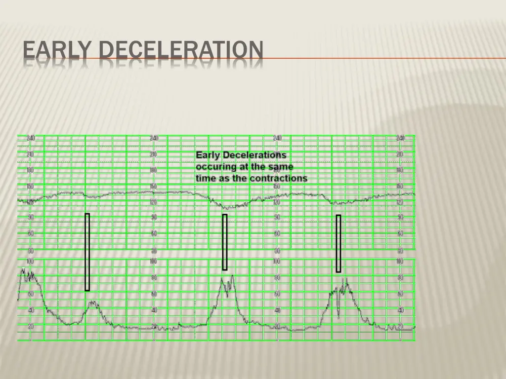 early deceleration