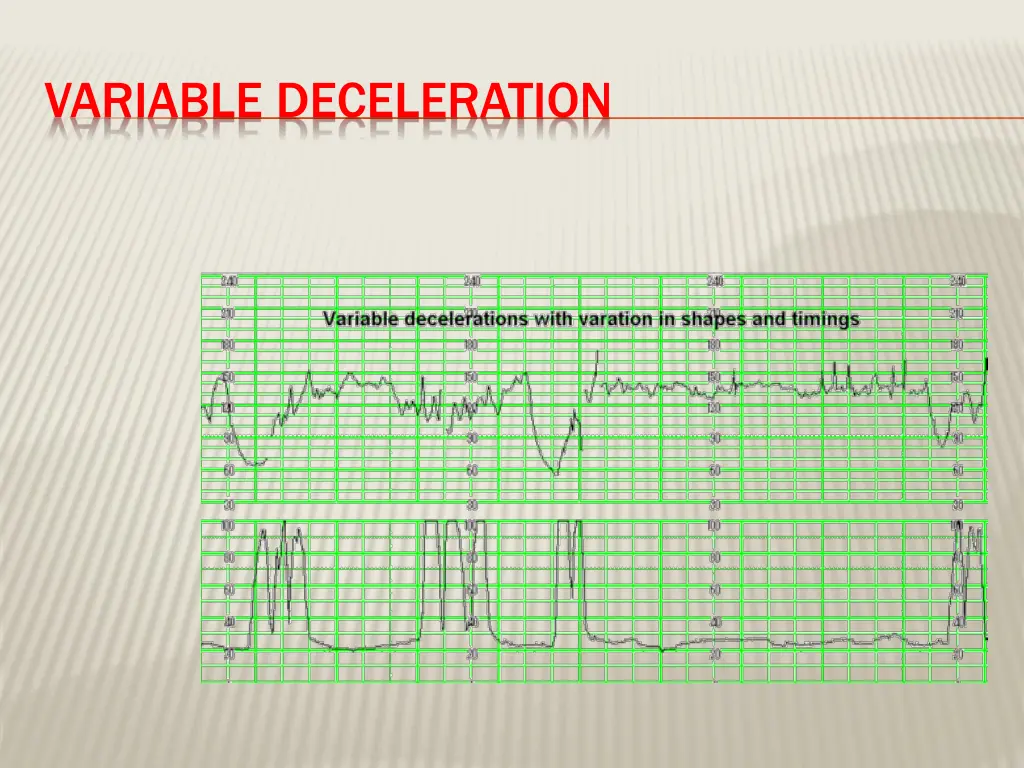 variable deceleration