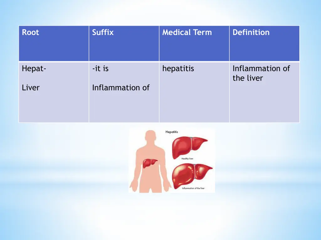slide11