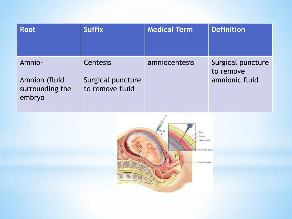 slide14