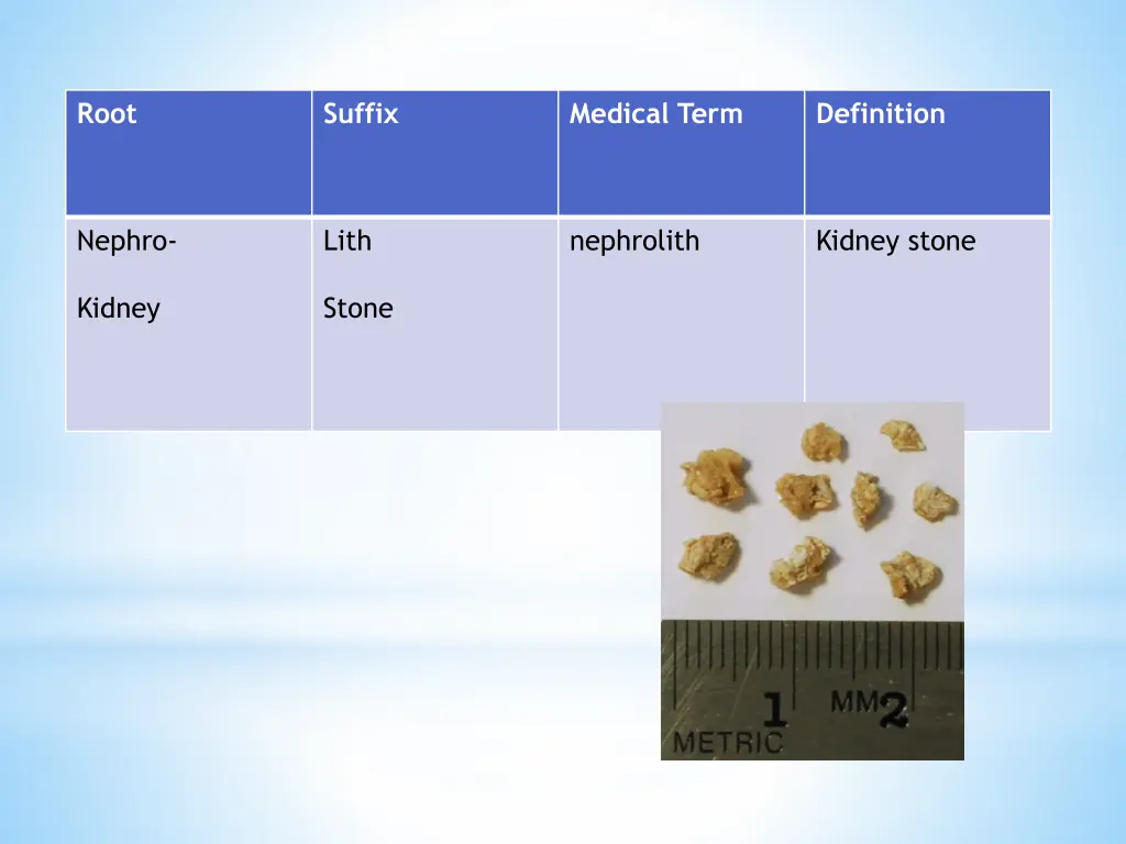 slide17