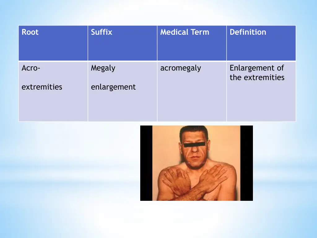 slide19