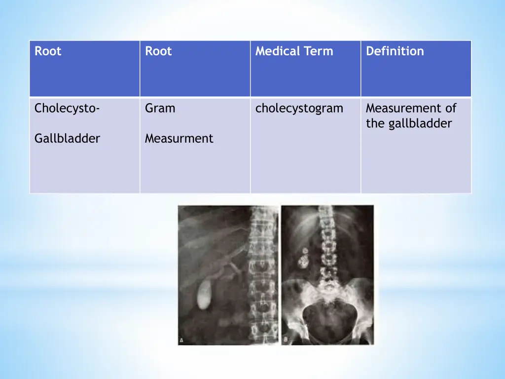 slide35