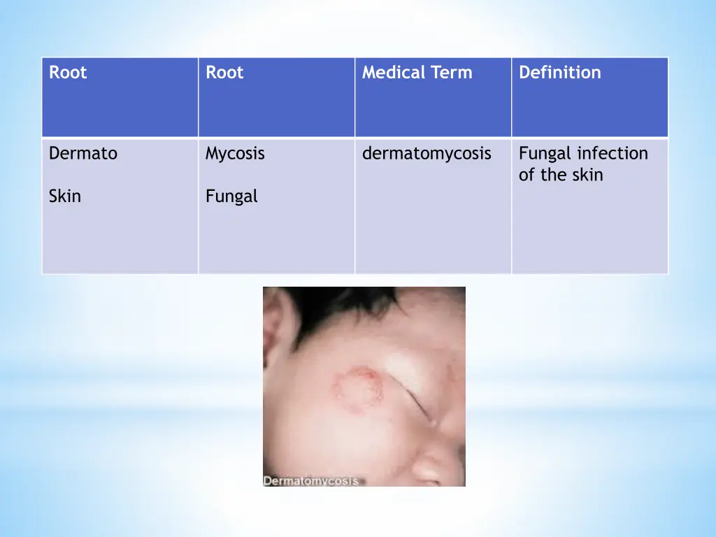slide36