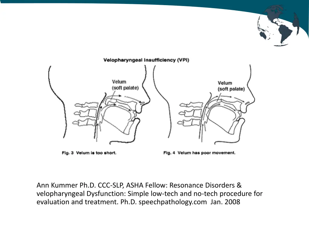 ann kummer ph d ccc slp asha fellow resonance