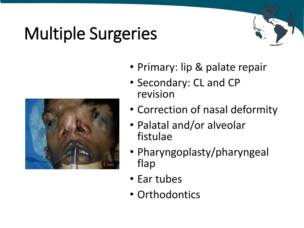 multiple multiple surgeries surgeries
