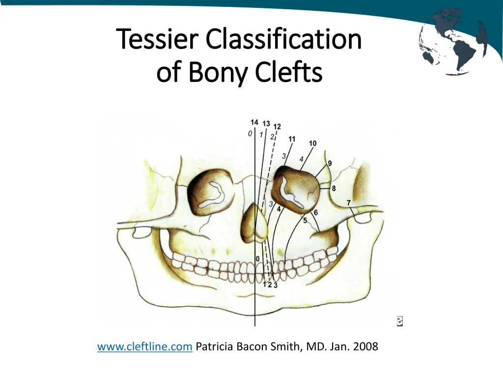 tessier tessier c classification lassification