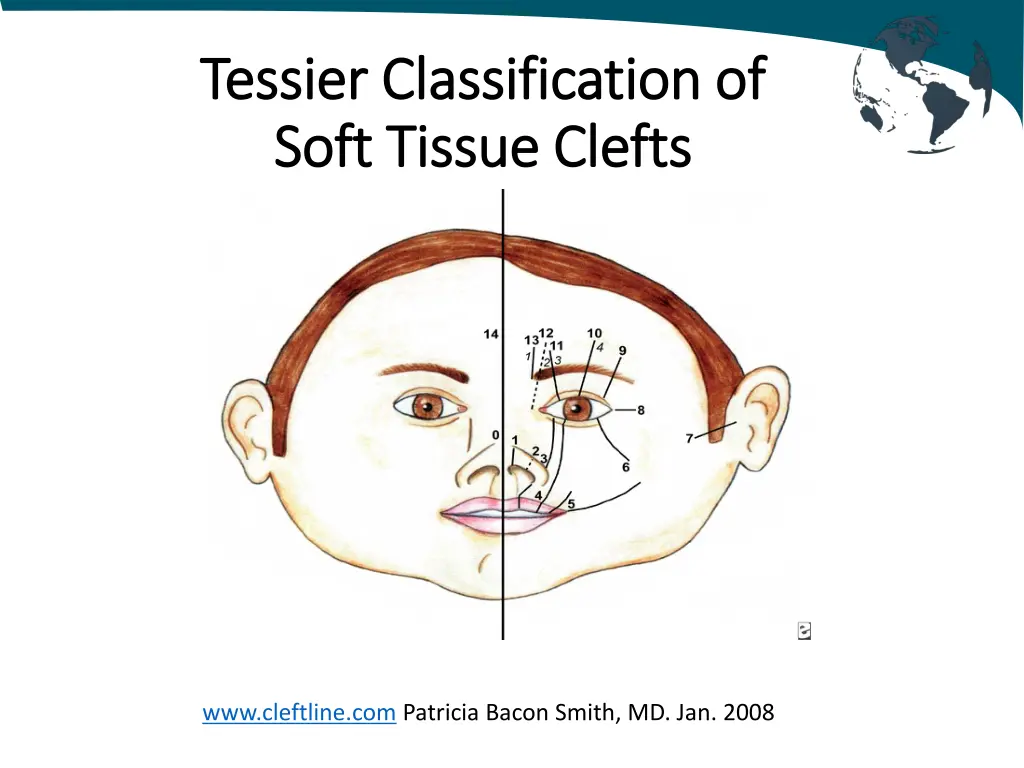tessier tessier classification classification