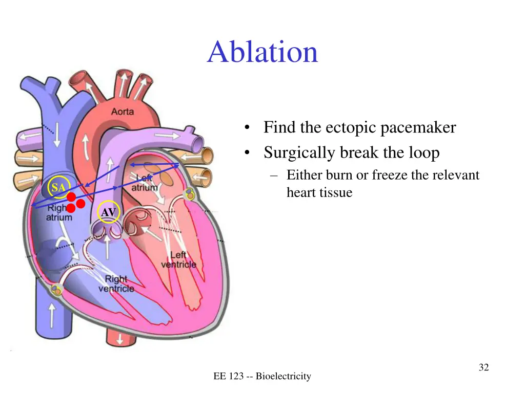 ablation 1