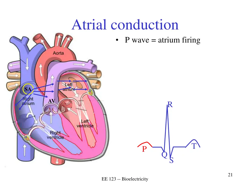atrial conduction p wave atrium firing