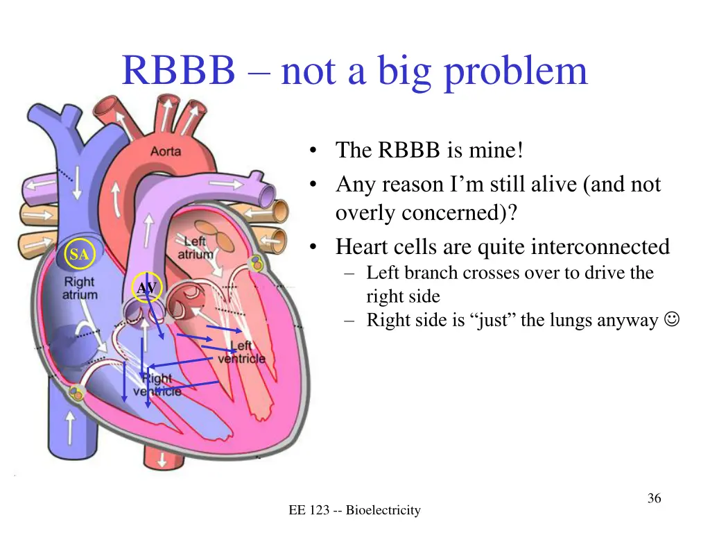 rbbb not a big problem