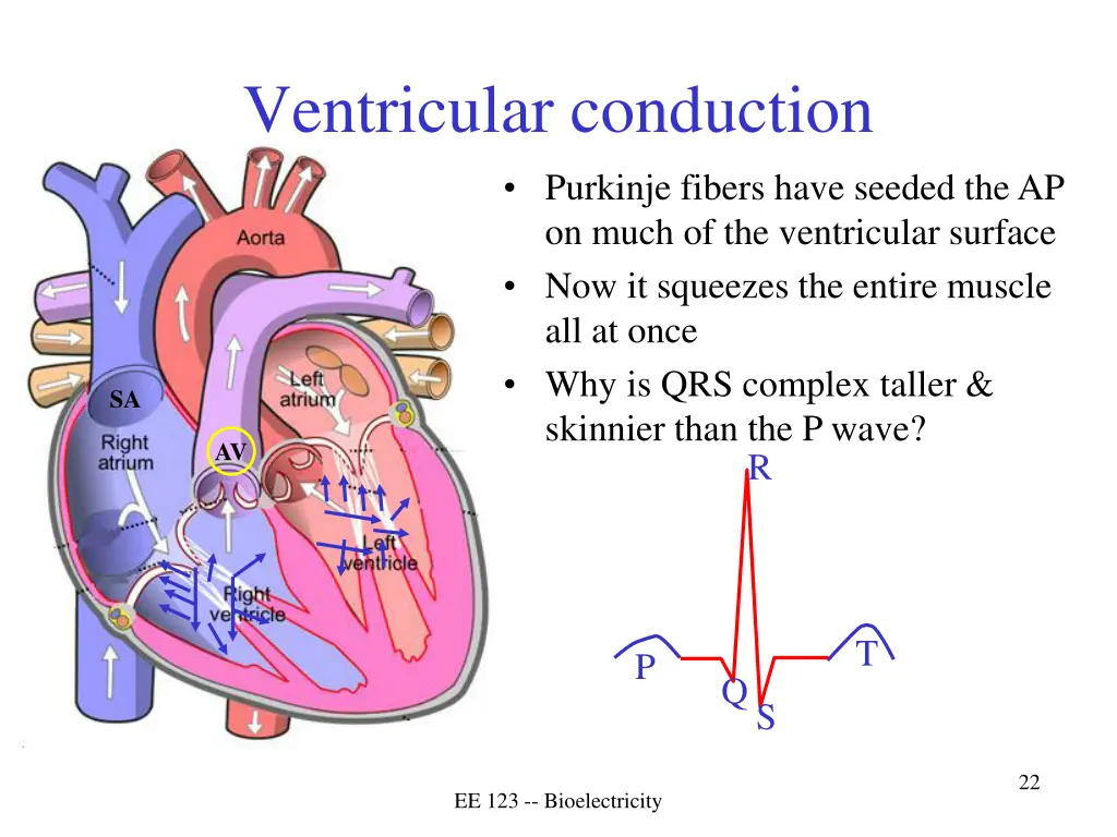 ventricular conduction 1