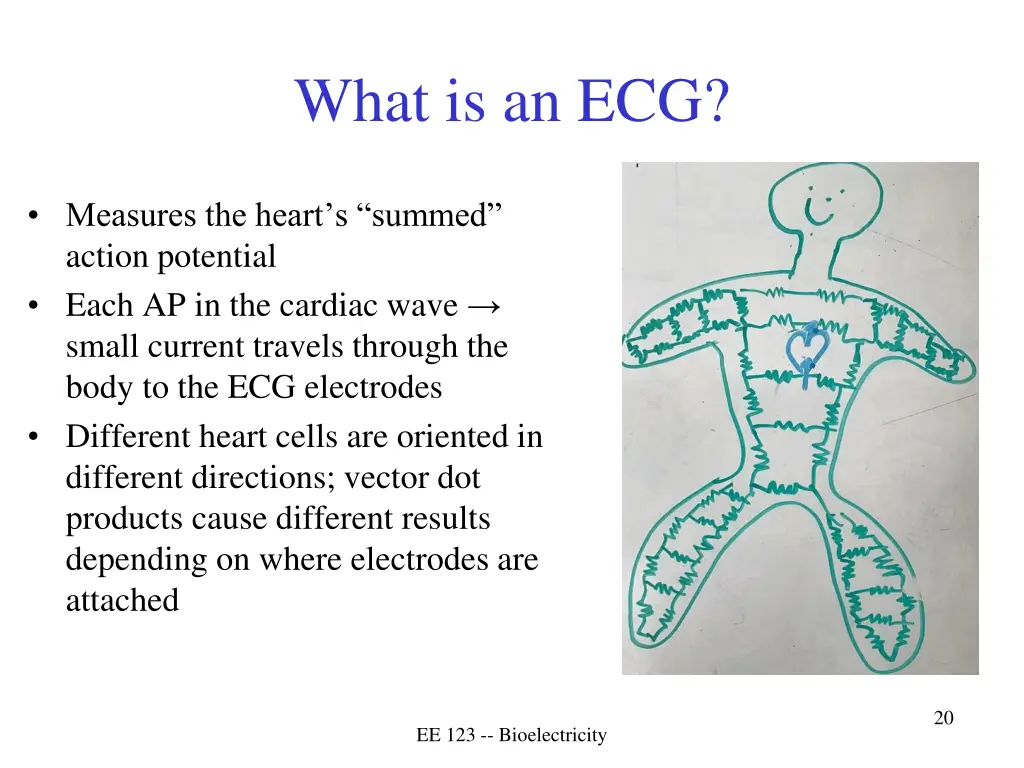 what is an ecg