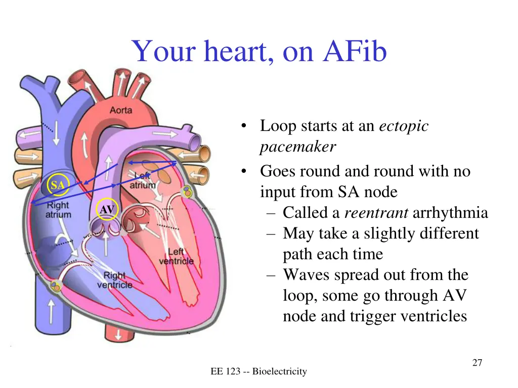 your heart on afib