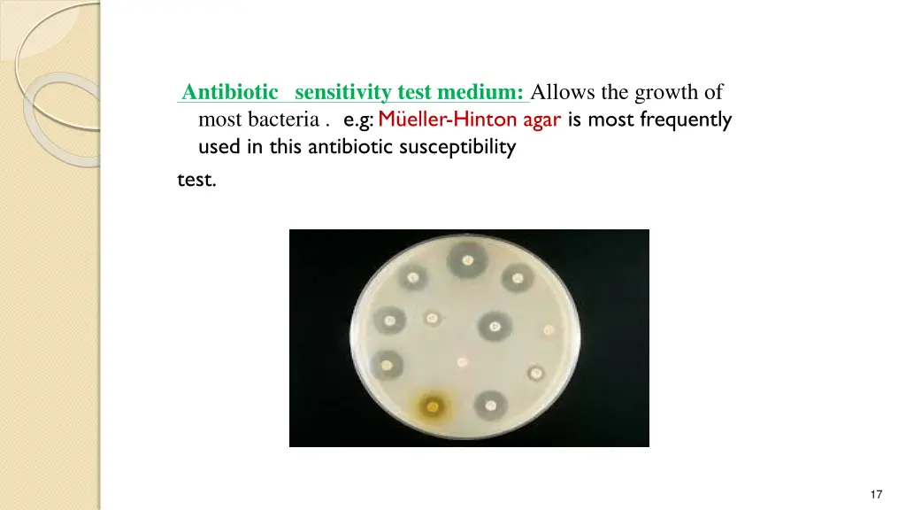 antibiotic sensitivity test medium allows