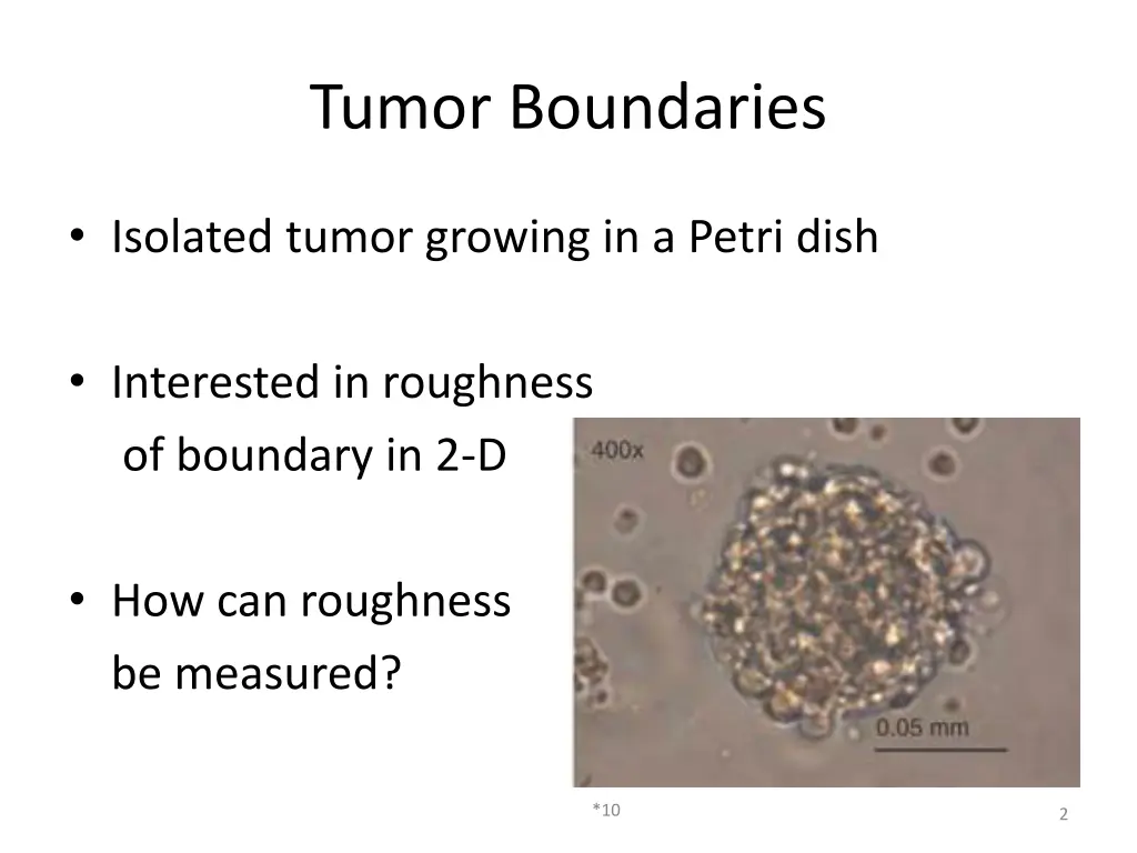 tumor boundaries