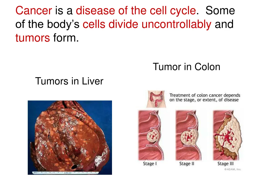 cancer is a disease of the cell cycle some