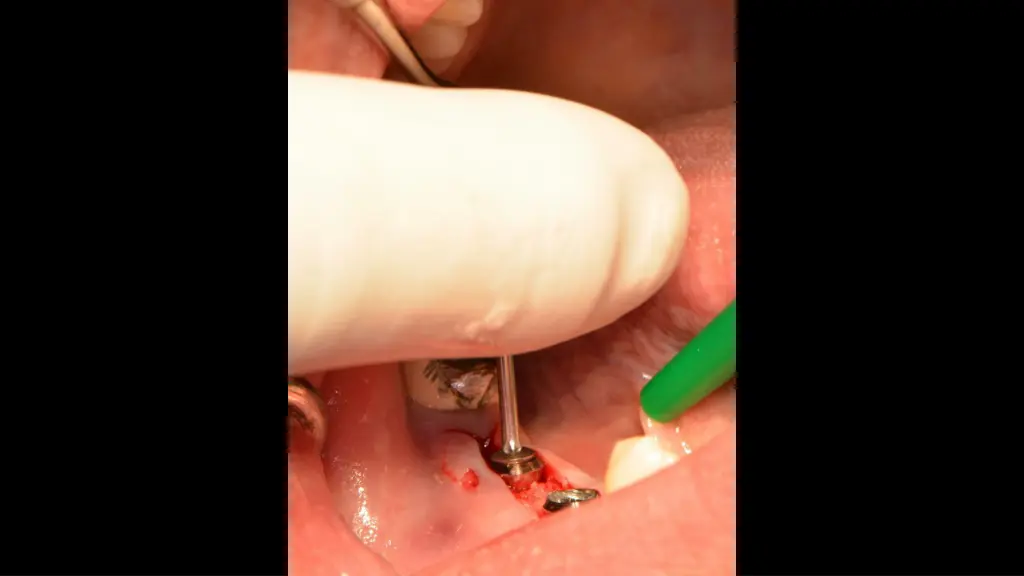 slide7