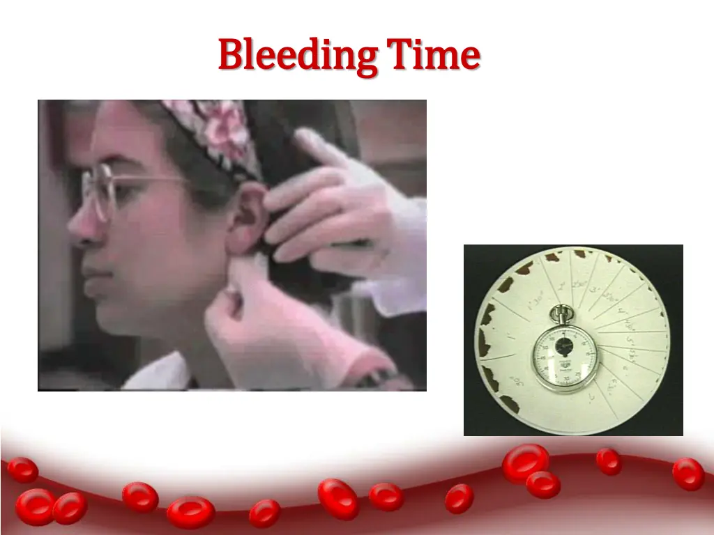 bleeding time bleeding time 2
