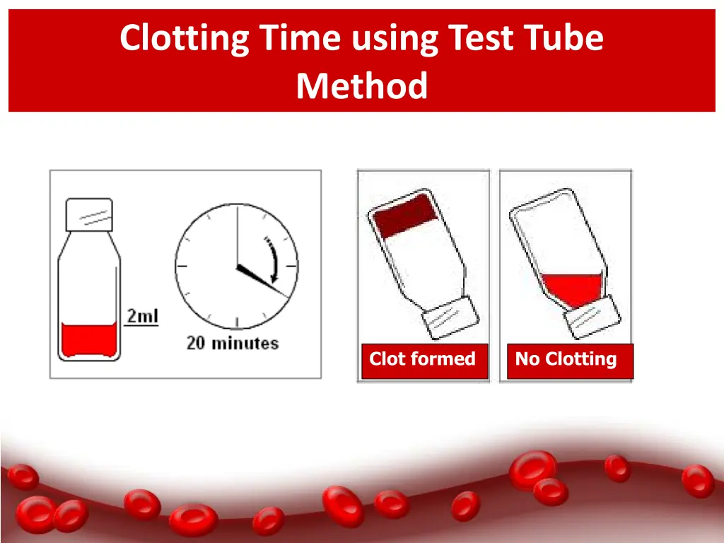 clotting time using test tube method