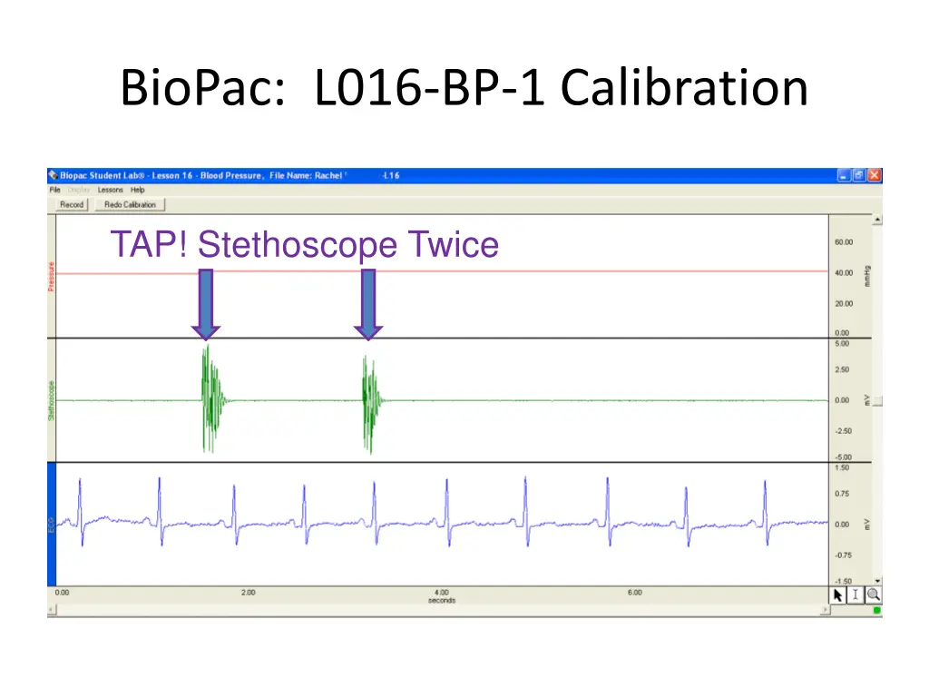 biopac l016 bp 1 calibration