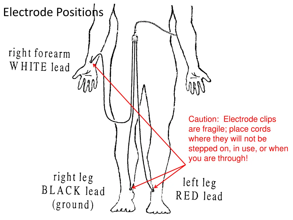 electrode positions