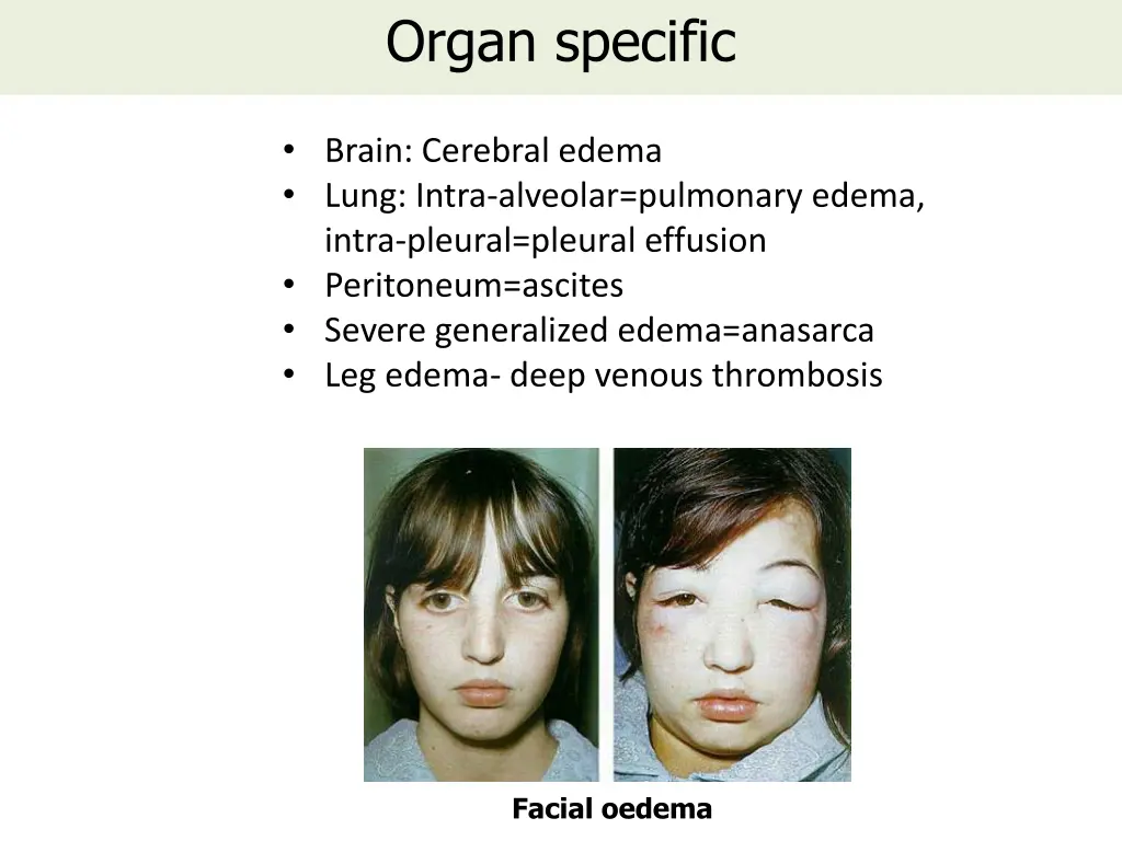 organ specific