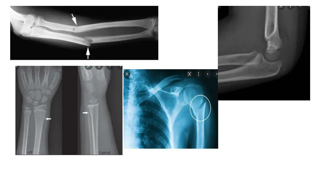 slide12