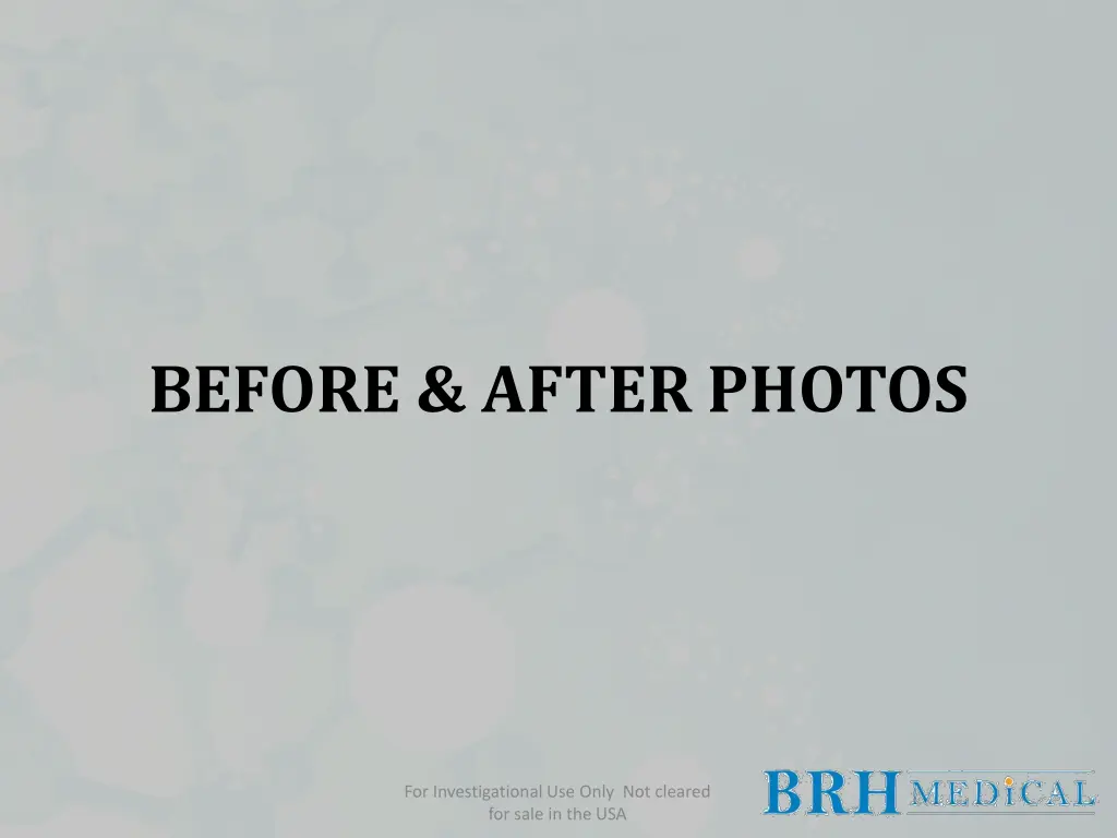 before after photos