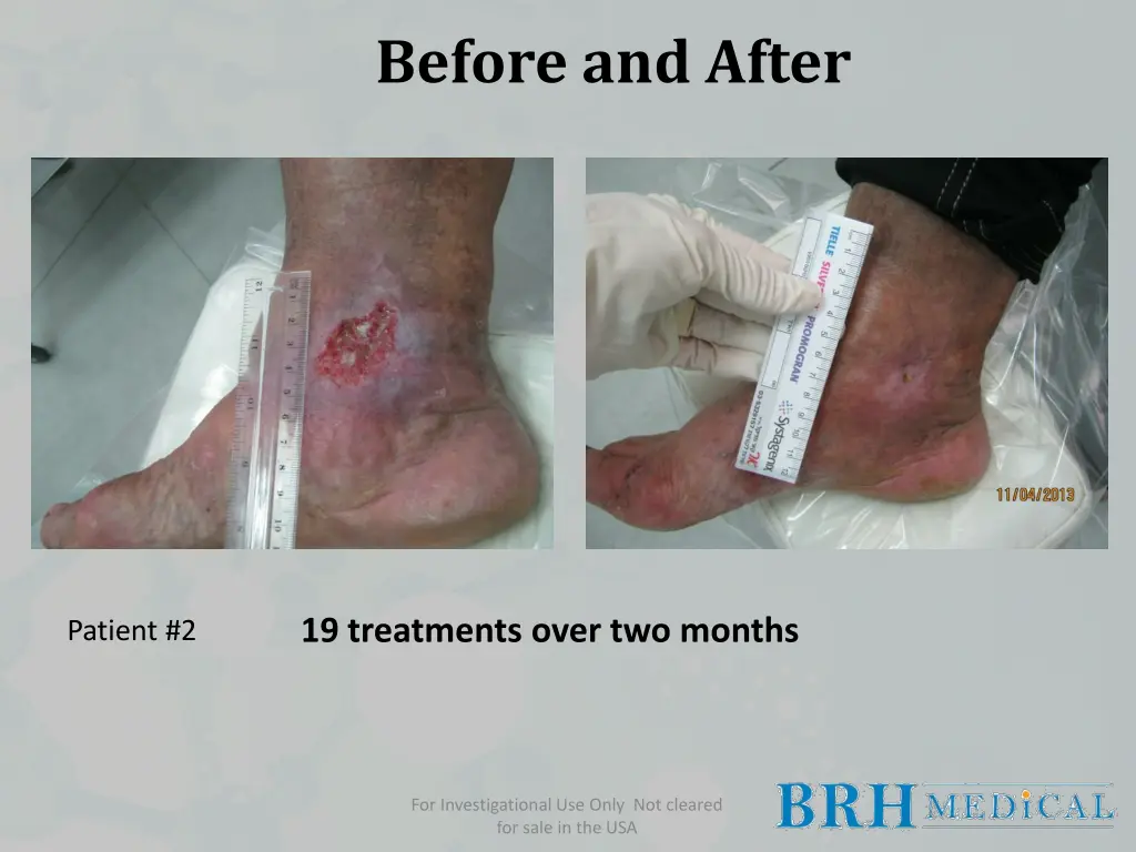 before and after 1