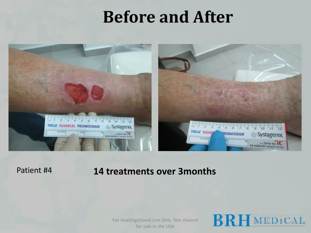 before and after 3