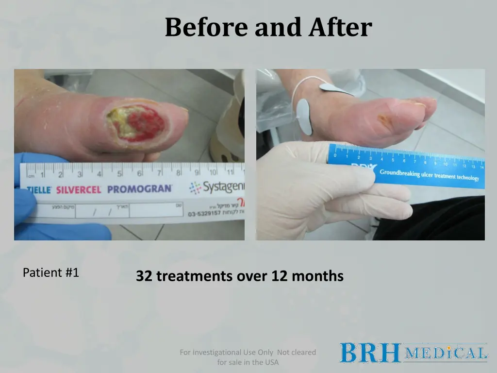 before and after