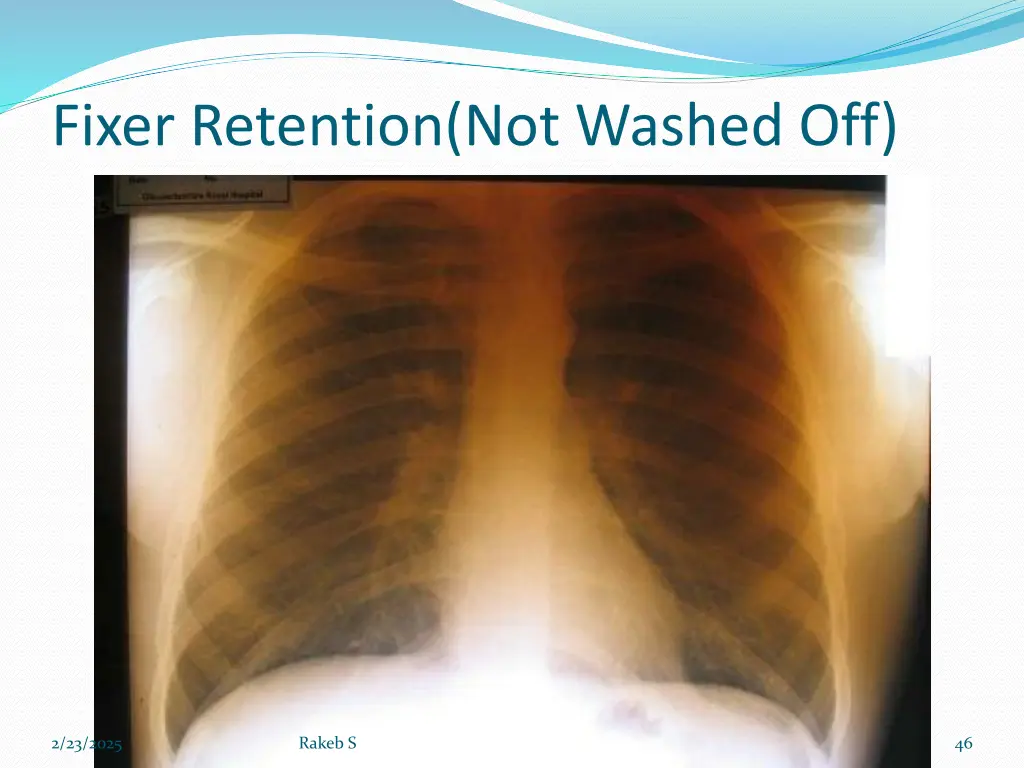 fixer retention not washed off
