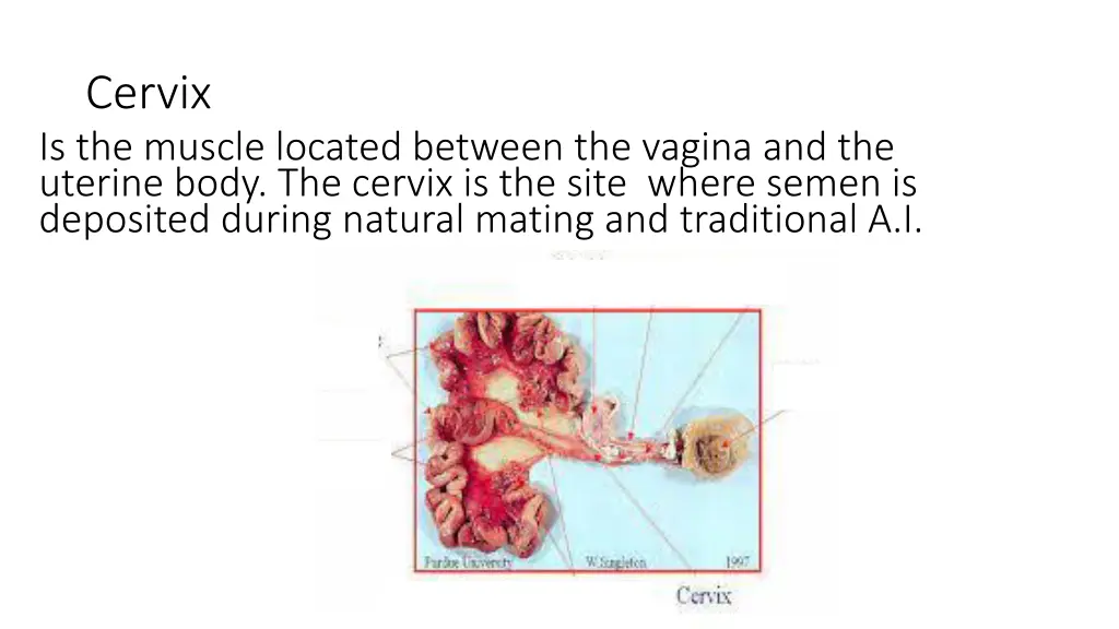 cervix is the muscle located between the vagina