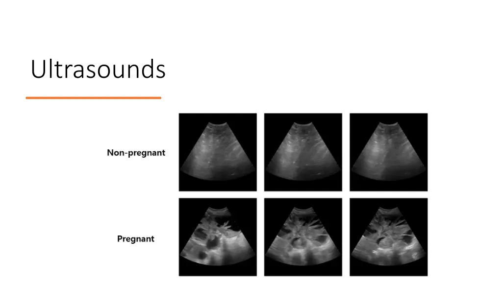 ultrasounds