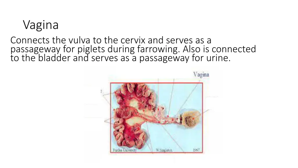 vagina connects the vulva to the cervix