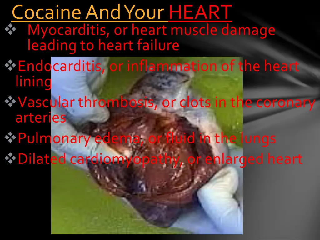 cocaine and your heart