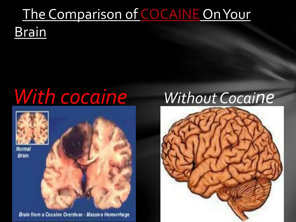 the comparison of cocaineon your brain