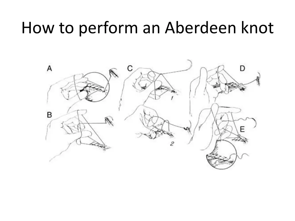 how to perform an aberdeen knot