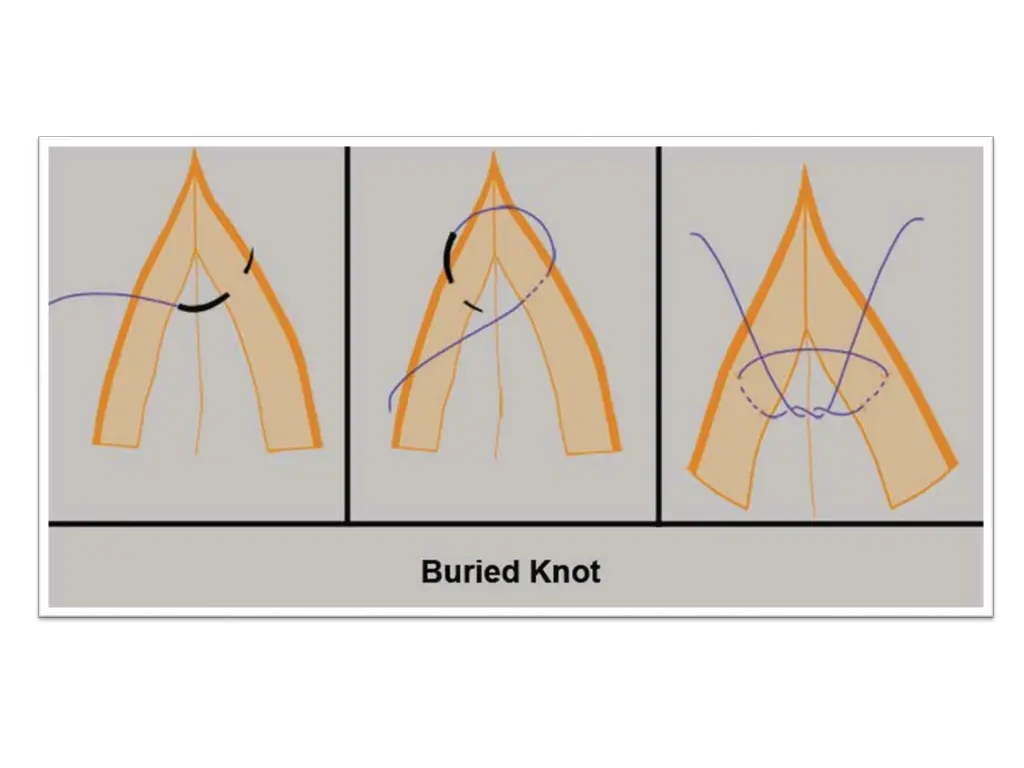 slide17
