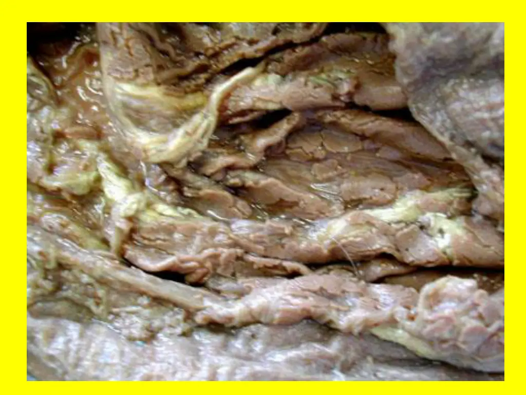 slide21
