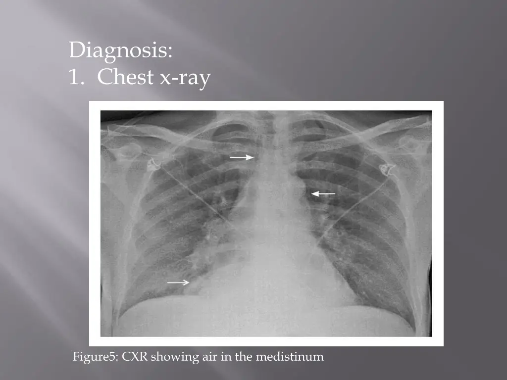 diagnosis 1 chest x ray
