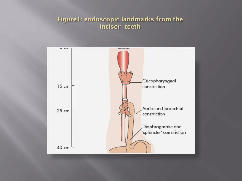 figure1 endoscopic landmarks from the incisor