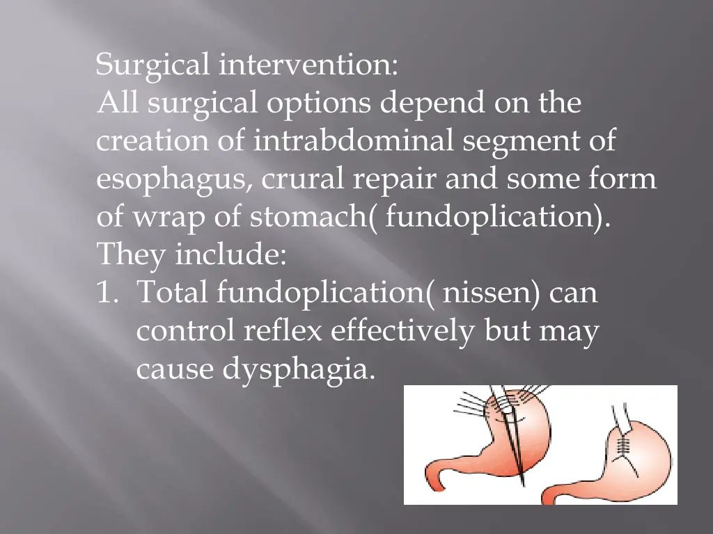 surgical intervention all surgical options depend