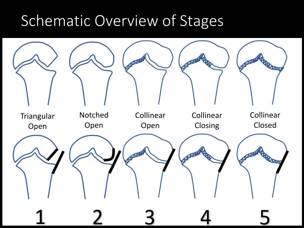 schematic overview of stages