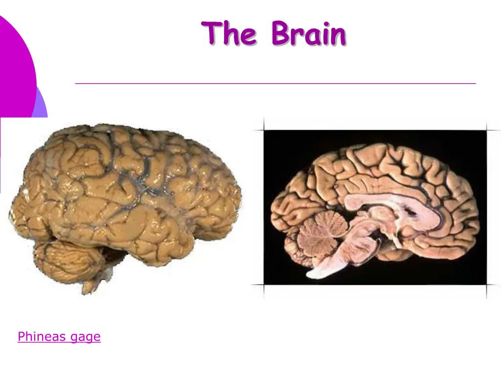 the brain 2