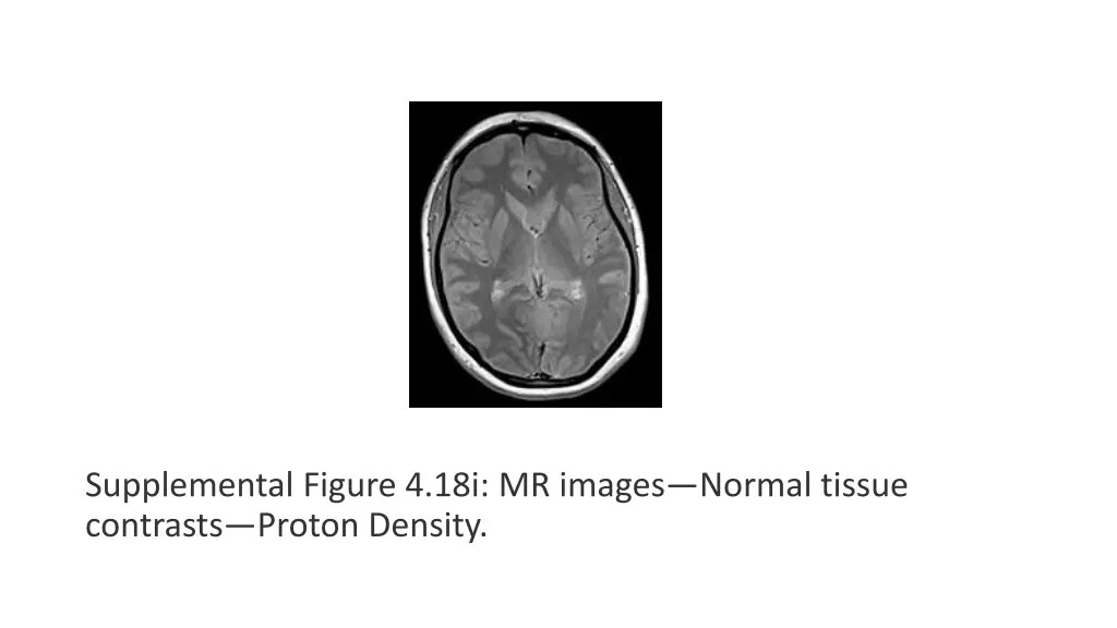 supplemental figure 4 18i mr images normal tissue