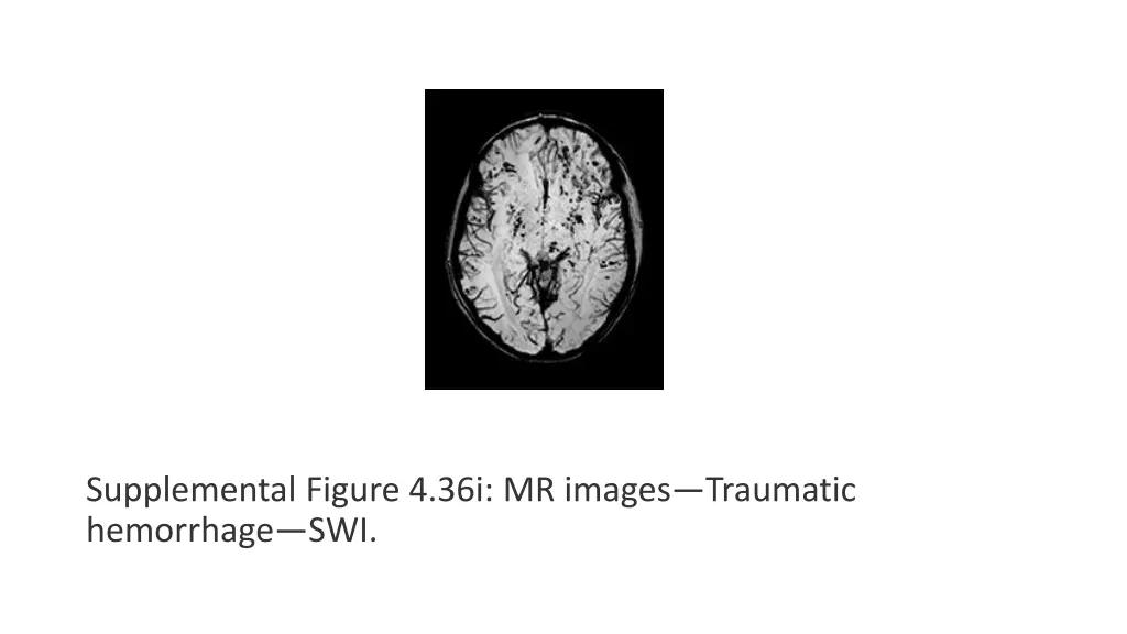 supplemental figure 4 36i mr images traumatic