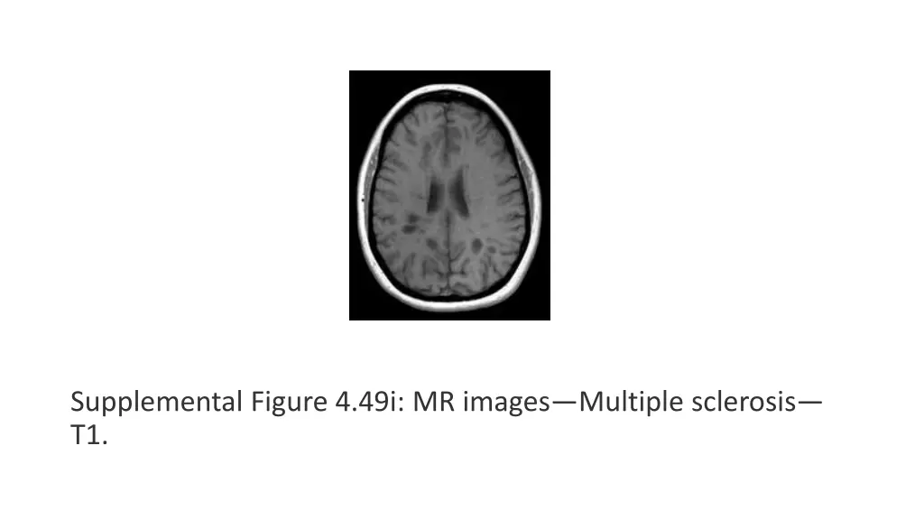 supplemental figure 4 49i mr images multiple
